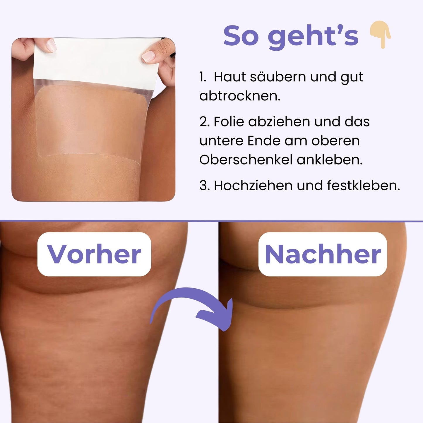 SculptThighs™ – Schlankheits- und Straffungslösung in nur wenigen Wochen