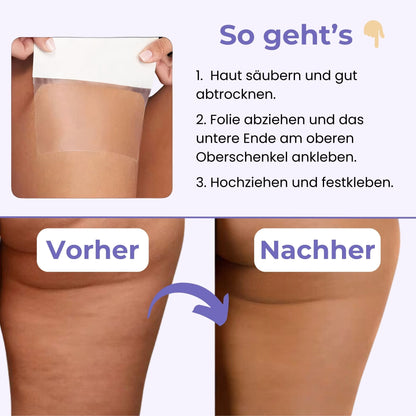 SculptThighs™ – Schlankheits- und Straffungslösung in nur wenigen Wochen