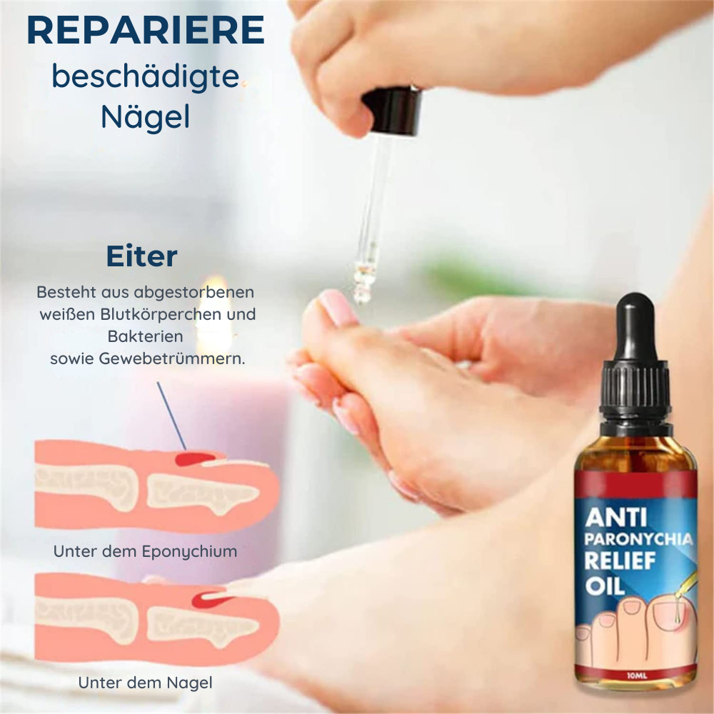 NägelBeruhigen™ Anti-Paronychia Pflegeöl