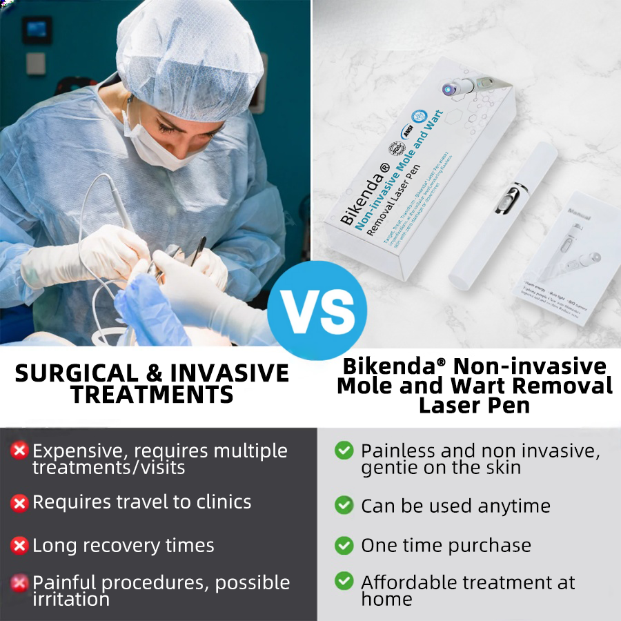 Vermoila® Nicht-invasiver Laserstift zur Entfernung von Muttermalen und Warzen Promax
