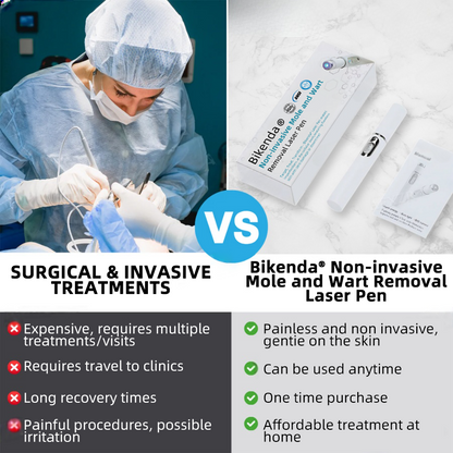 Vermoila® Nicht-invasiver Laserstift zur Entfernung von Muttermalen und Warzen Promax