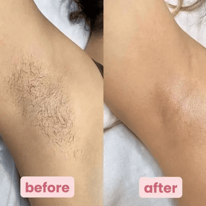 PetalSmooth™ Pro Shaving System