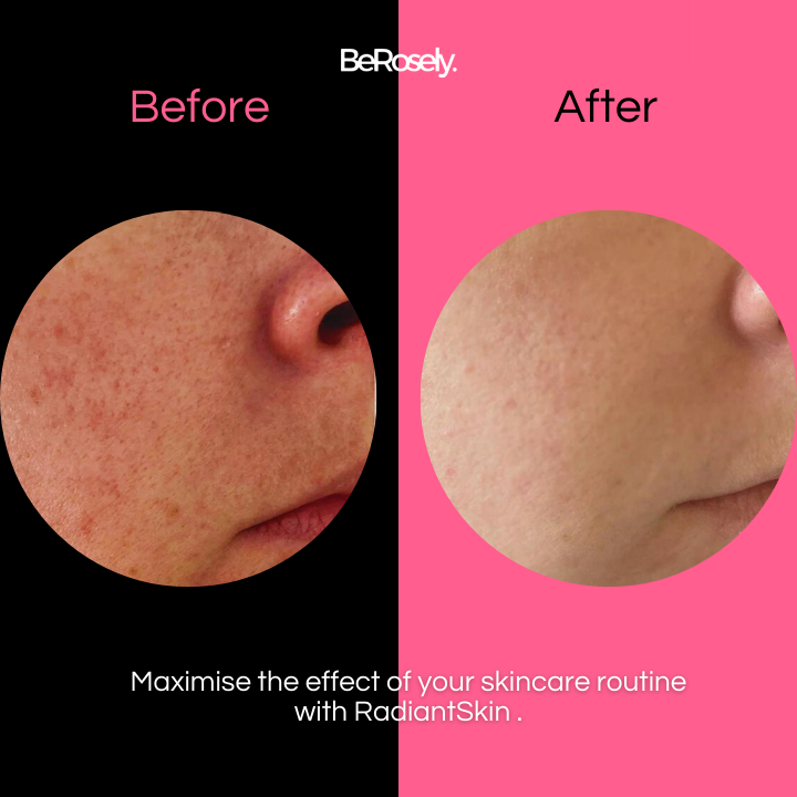 RadiantSkin™ Sanfte Duschbürste