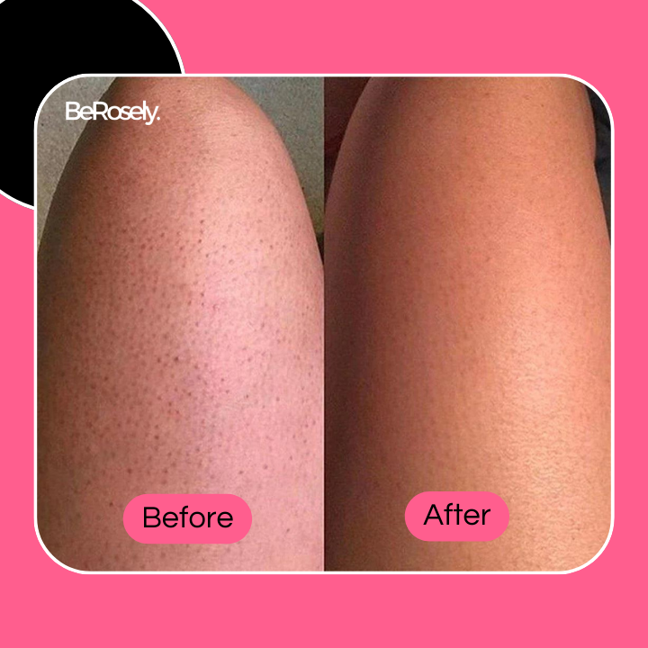 RadiantSkin™ Sanfte Duschbürste