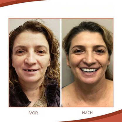 ProthesenKumpel™ Lösung für ein selbstbewusstes Lächeln