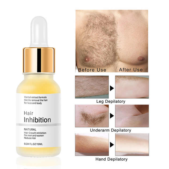 Smoothify™ Dauerhafte Haarentfernung | 1+1 GRATIS