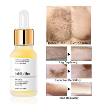 Smoothify™ Dauerhafte Haarentfernung | 1+1 GRATIS