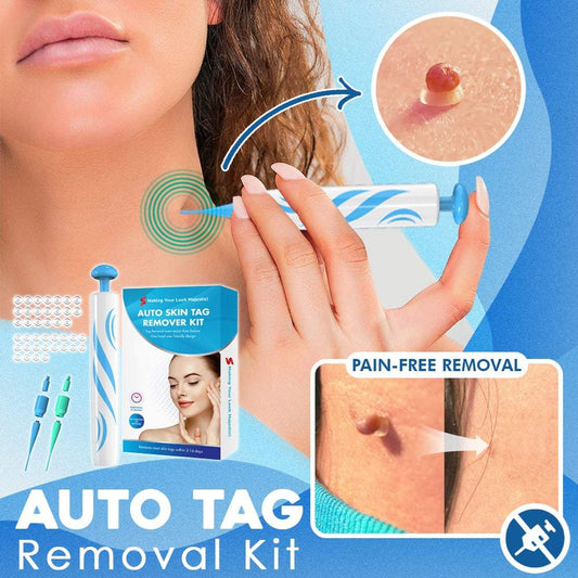 Schmerzlose Entfernung von Hautanhängseln – Auto SKIN TAG Kit mit 50% Rabatt