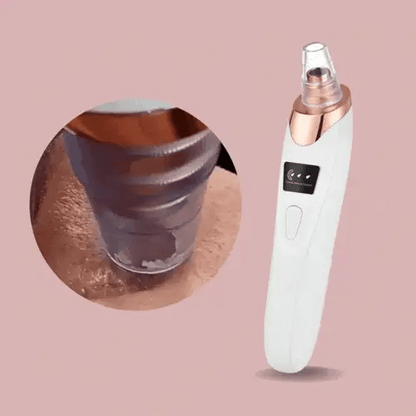 PoreGlow™ Mitesser-Entferner