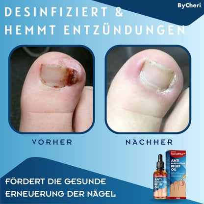 HeilungsTropfen™ Beschädigte Nägel in 4 Wochen wiederherstellen