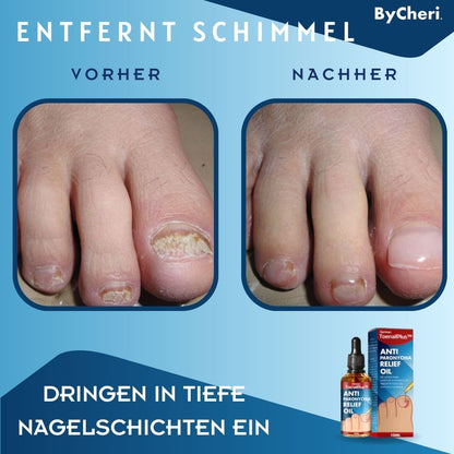 HeilungsTropfen™ Beschädigte Nägel in 4 Wochen wiederherstellen