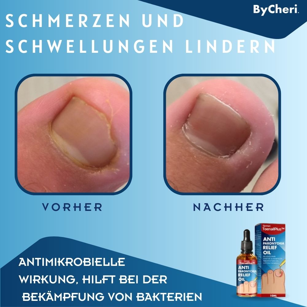 HeilungsTropfen™ Beschädigte Nägel in 4 Wochen wiederherstellen