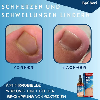 HeilungsTropfen™ Beschädigte Nägel in 4 Wochen wiederherstellen