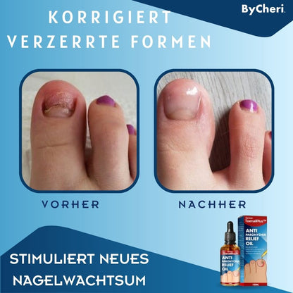 HeilungsTropfen™ Beschädigte Nägel in 4 Wochen wiederherstellen