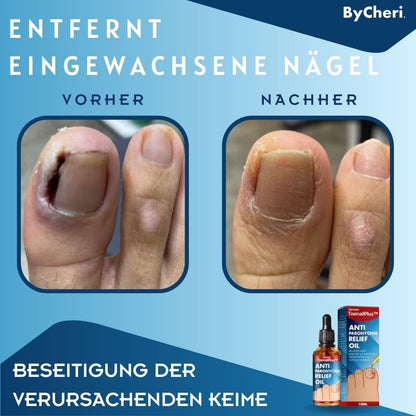 HeilungsTropfen™ Beschädigte Nägel in 4 Wochen wiederherstellen