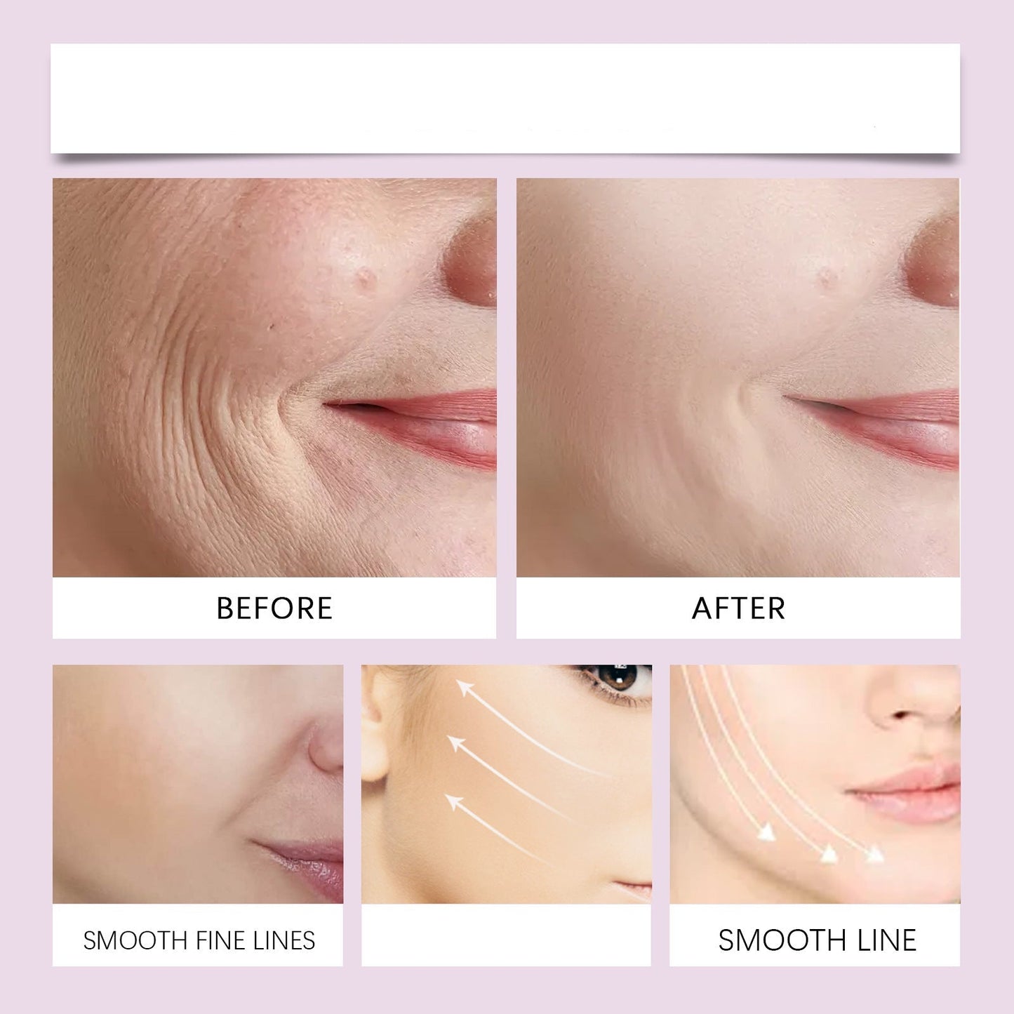 Jeune™ - Unsichtbares Facelifting Tape
