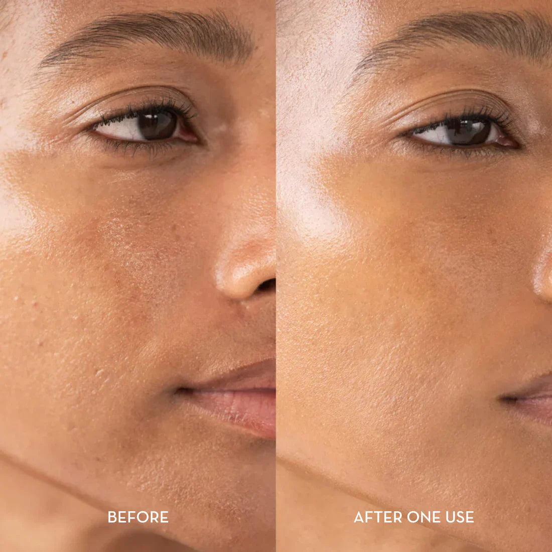 Sanfte Hauterneuerung – Glyssa Rice Peel Duo