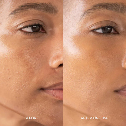 Sanfte Hauterneuerung – Glyssa Rice Peel Duo